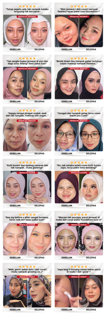 Perbandingan sebelum dan selepas menggunakan Luxe Perfect Cover Foundation