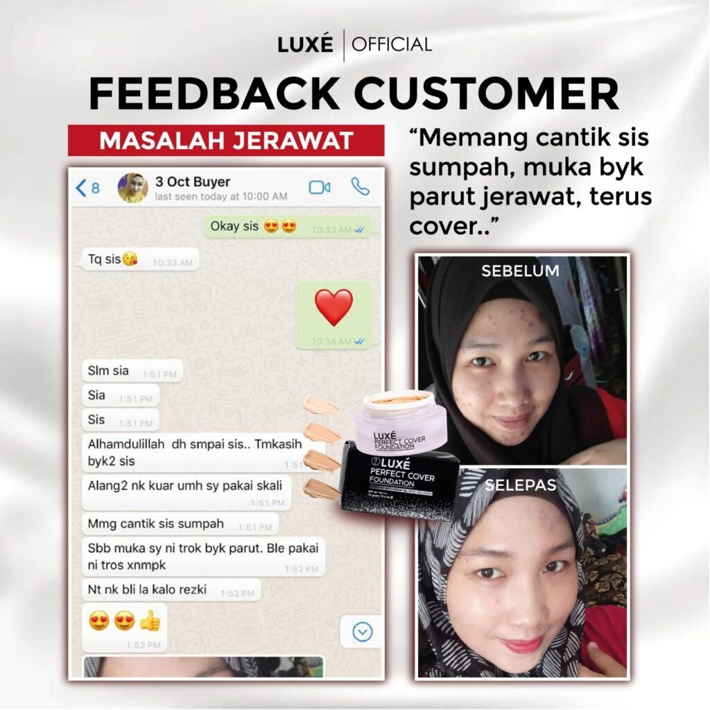 Testimoni pelanggan Luxe Perfect Cover Foundation untuk masalah jerawat dan jeragat (1)