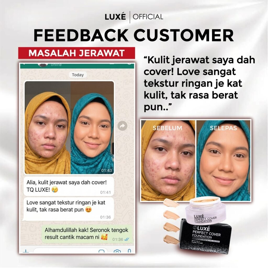 Testimoni pelanggan Luxe Perfect Cover Foundation untuk masalah jerawat dan jeragat (4)