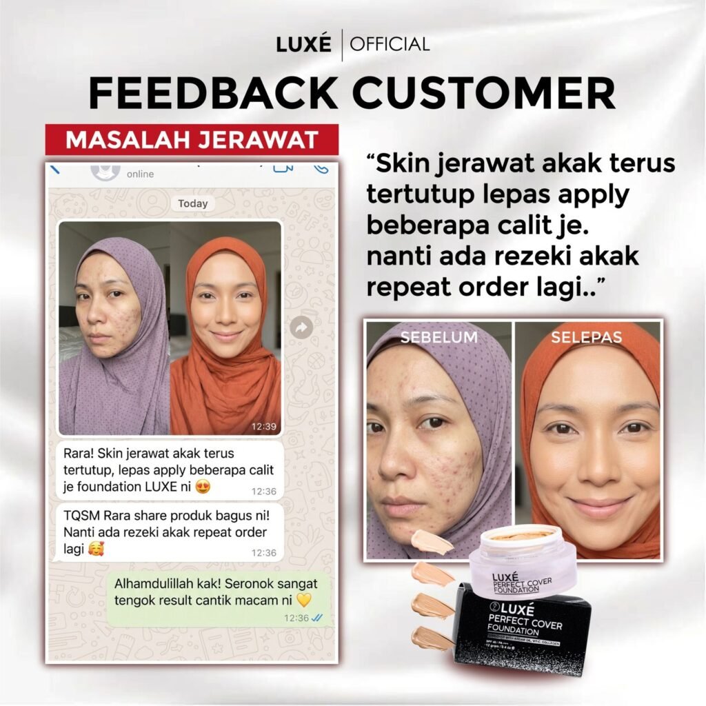 Testimoni pelanggan Luxe Perfect Cover Foundation untuk masalah jerawat dan jeragat (5)