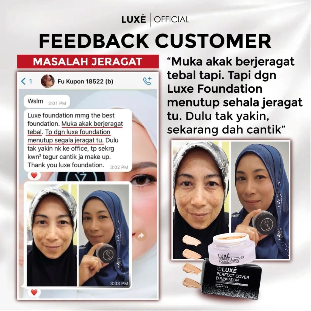 Testimoni pelanggan Luxe Perfect Cover Foundation untuk masalah jerawat dan jeragat (6)