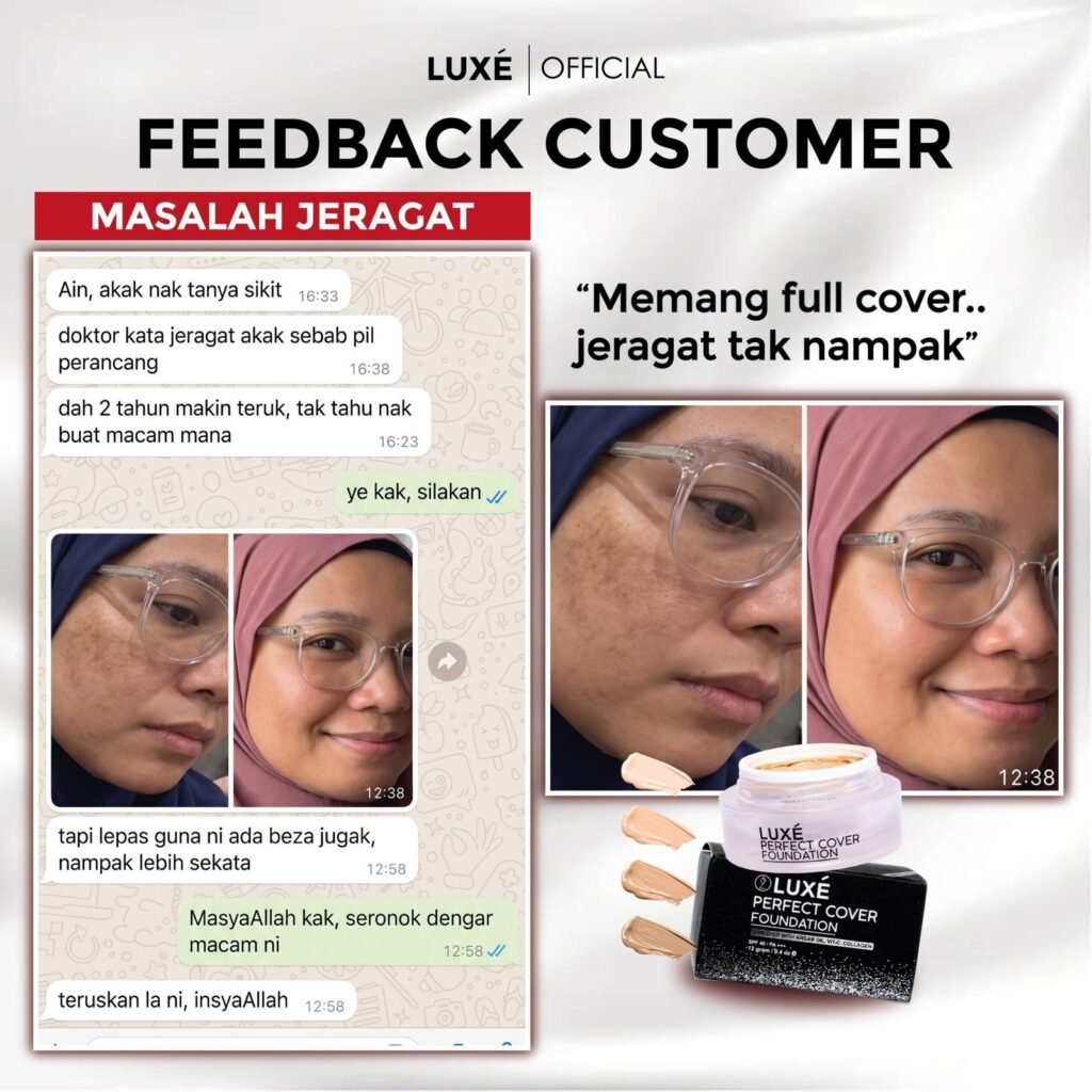 Testimoni pelanggan Luxe Perfect Cover Foundation untuk masalah jerawat dan jeragat (7)