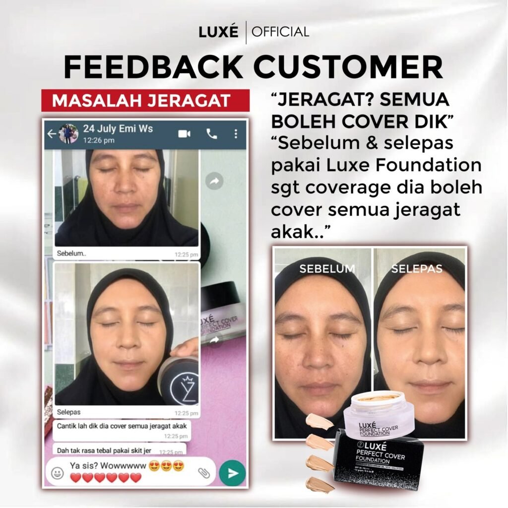 Testimoni pelanggan Luxe Perfect Cover Foundation untuk masalah jerawat dan jeragat (8)