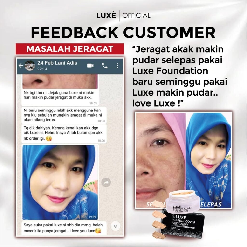 Testimoni pelanggan Luxe Perfect Cover Foundation untuk masalah jerawat dan jeragat (9)