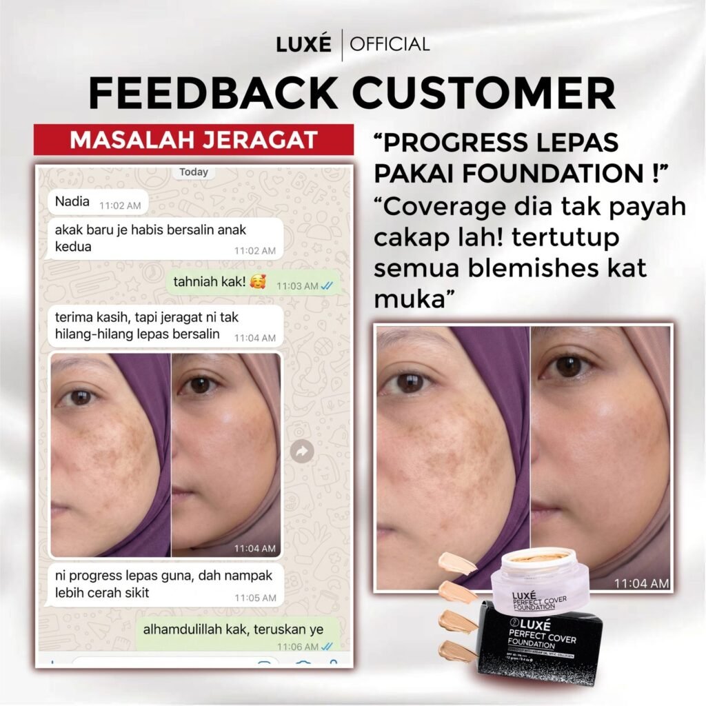 Testimoni pelanggan Luxe Perfect Cover Foundation untuk masalah jerawat dan jeragat (10)